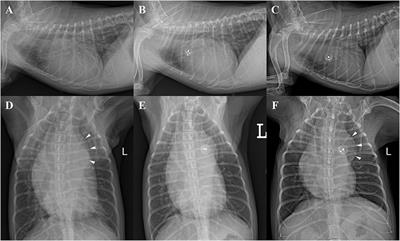 Case Report: Aortic Regurgitation of Postocclusion and Long-Term Outcome Following PDA Correction in an Adult Dog